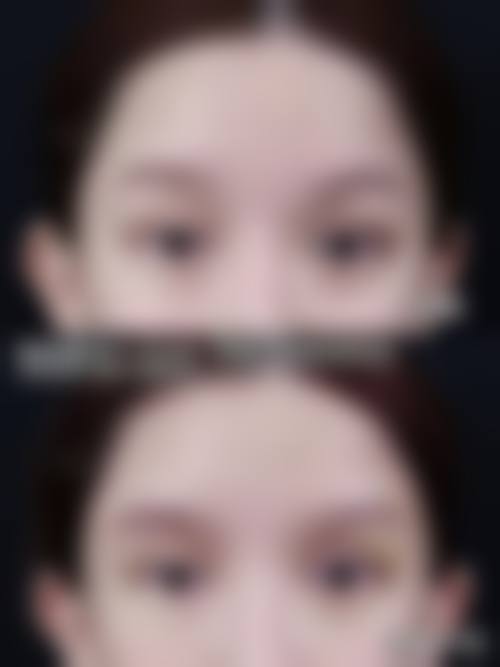 庄原美容外科诊所价格表/收费区间参考