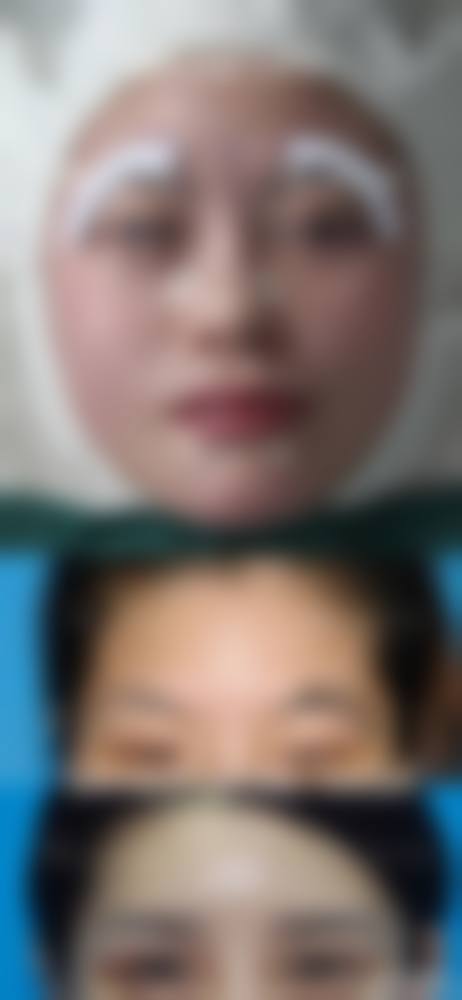 三、韩国秀梦HUMAN整形外科开展项目及特色技术