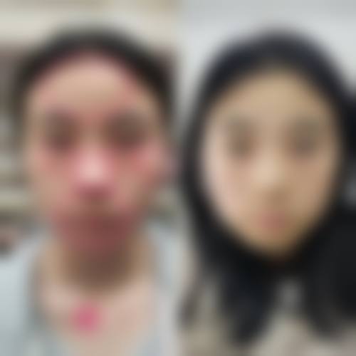 国内医 科 大学附院第一医院整形美容科医生介绍