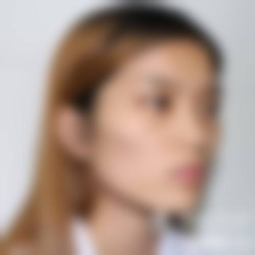 韩国优雅人整形外科医院是莆田系吗？答案揭晓，它是正规非莆田系，还上榜韩胸整排名！ 