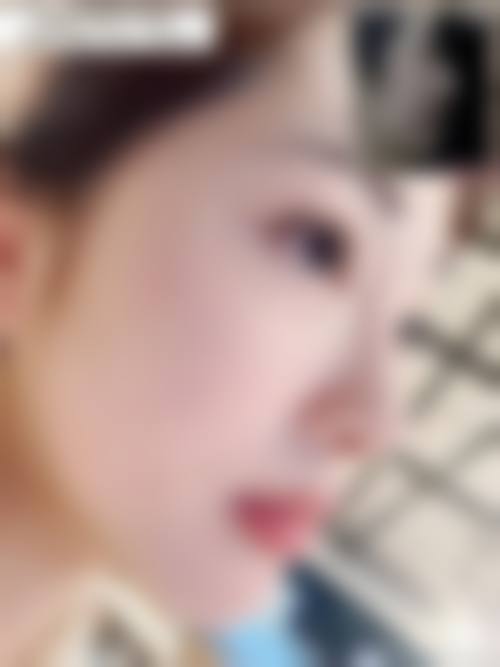 韩国优雅人整形外科医院医生介绍：朴哲佑院长的"金鼻修复"传奇