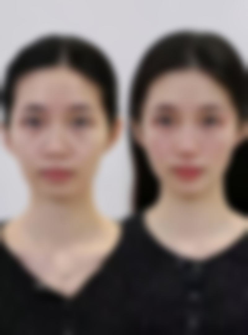 三、杭州连天美医疗美容医院王牌项目全解析，覆盖全年龄段医美需求整形、皮肤、口腔、中医美容一站式搞定