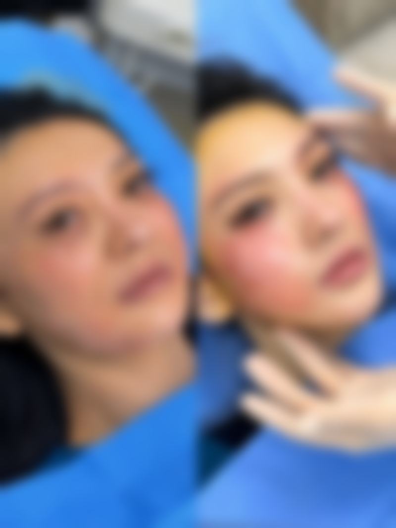 硅胶隆鼻是什么?通常在什么医学背景下被选择?