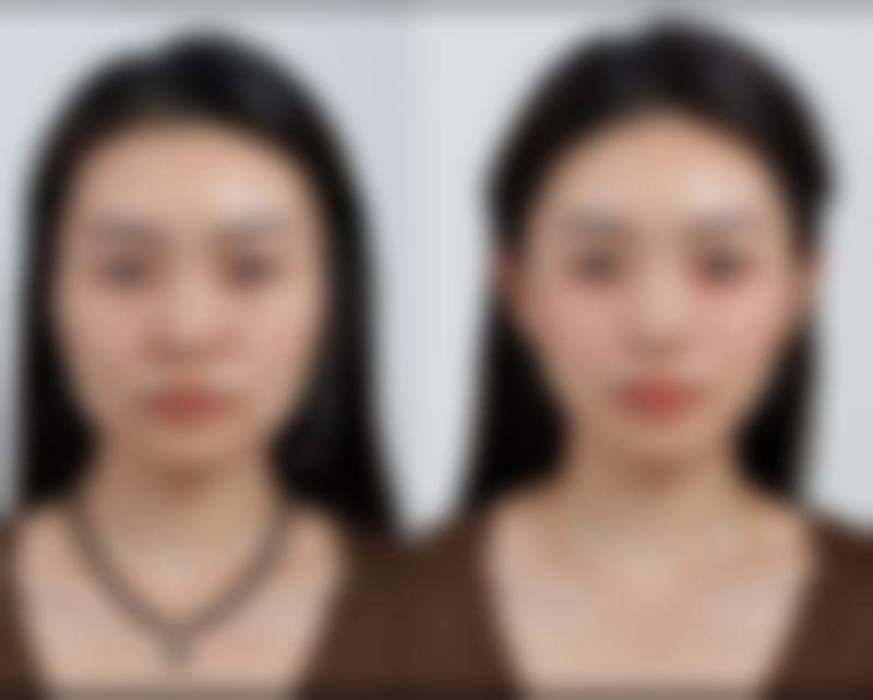 国内医 科 大学附院第一医院整形美容科口碑如何