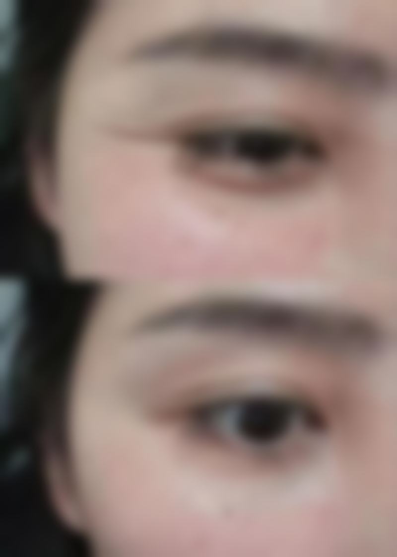 沈阳北方整形外科的避坑要点:这些细节一定要注意