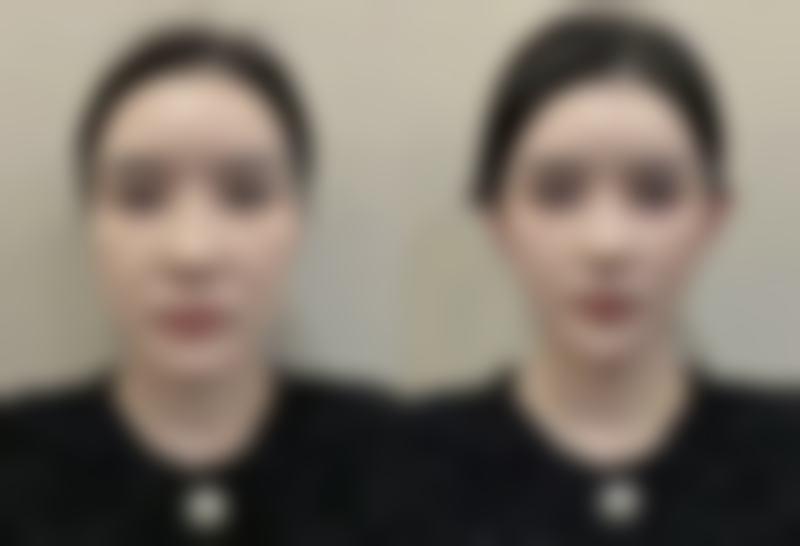 片桐衣理医生技术水平高