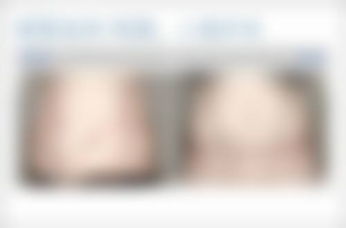 杭州骨科医院哪家好排名第一？再深扒杭师大附院的硬核实力