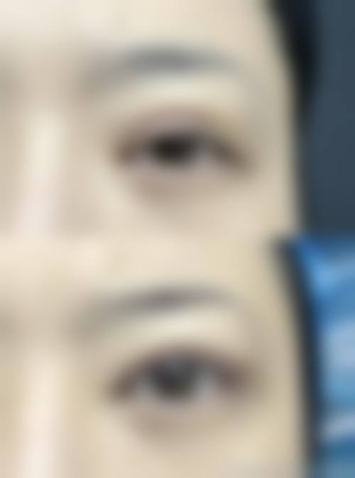 三、饶焱医生技术水平高吗?技术厉害吗?