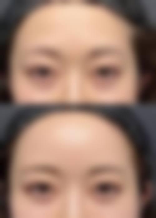 七、饶焱医生整形项目价格表/收费标准一览(2026 年全新)