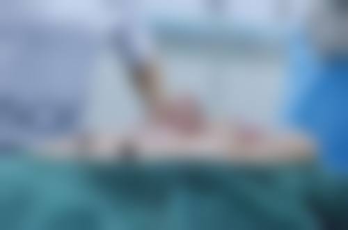 优雅人整形擅长项目大盘点：鼻修复堪称行业标杆！