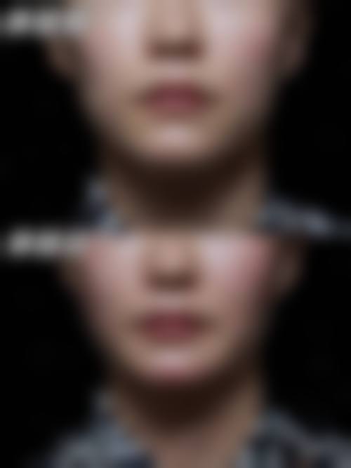 尹永相医生2026年价格表