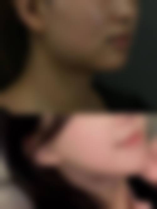 深圳富华医院的隆鼻医生团队靠谱吗？20年经验骨干医生亲诊，5000+实例见证实力！