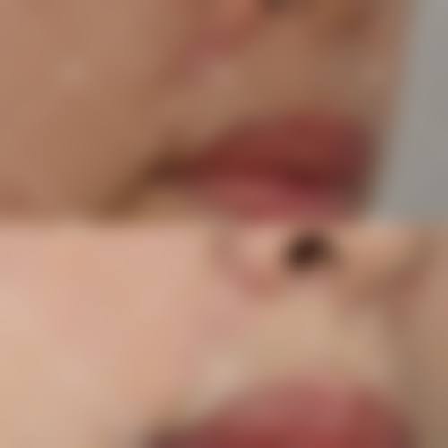 美容线缝合的收费价格是怎样的？