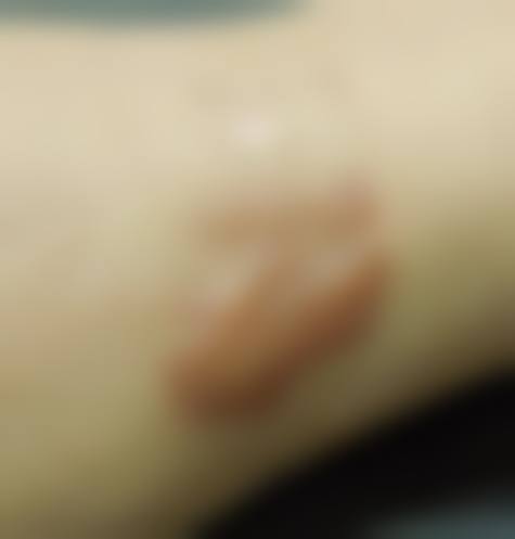 【医疗风险告知书】