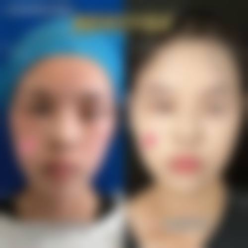 三、上海医美整形项目收费情况(2026年全新价格)