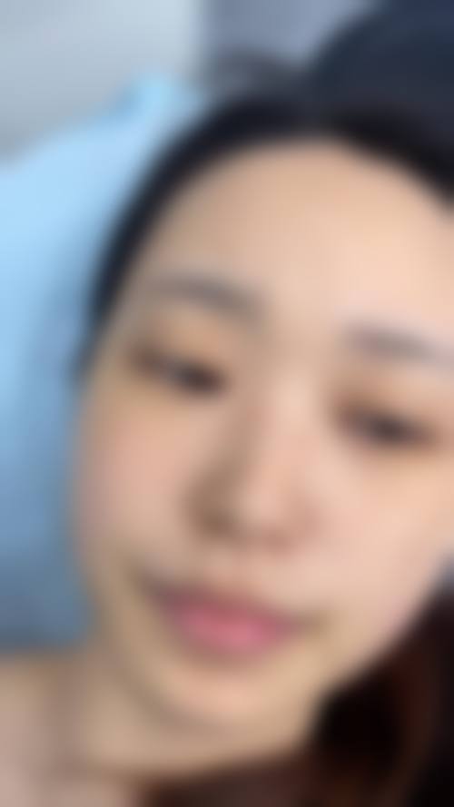 三、金智娟医生擅长项目与适合人群