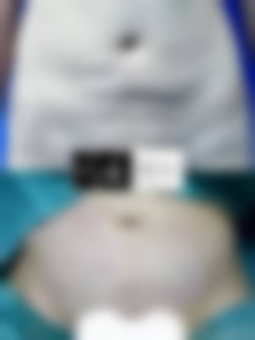 韩国优雅人整形外科医院医生介绍：学术与实战兼具的朴哲佑院长