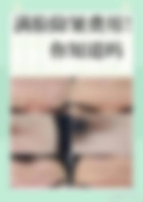 上海打肉毒素哪家医院做的好？美莱分层精准注射技术实测，时光老牌深层除皱更靠谱！