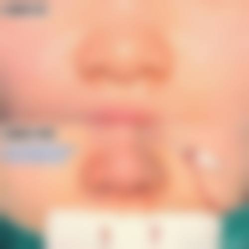 在决定是否选择隆鼻假体前，普通用户更容易忽略的关键评估点及医院医生推荐名单