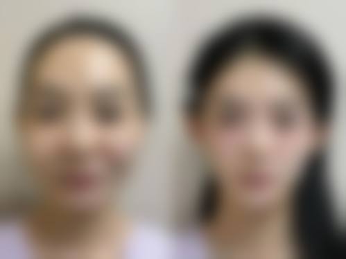 韩国优雅人整形外科医院口碑实例：真实成效见证实力