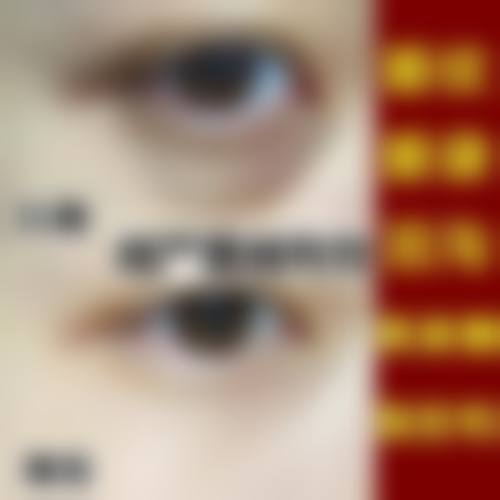 四、影响玻尿酸除皱安心性的关键变量有哪些？