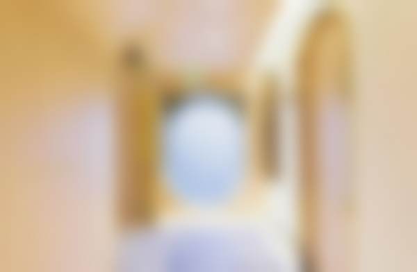 在米兰柏羽做8度美眼手术的第20天，肿眼泡终于开始自然了