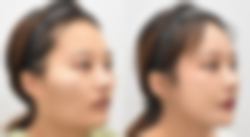 七、Cellpia医院收费标准2026参考