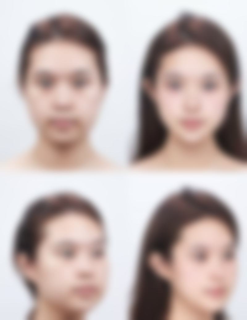 相关科普内容推荐：鼻综合整形详解