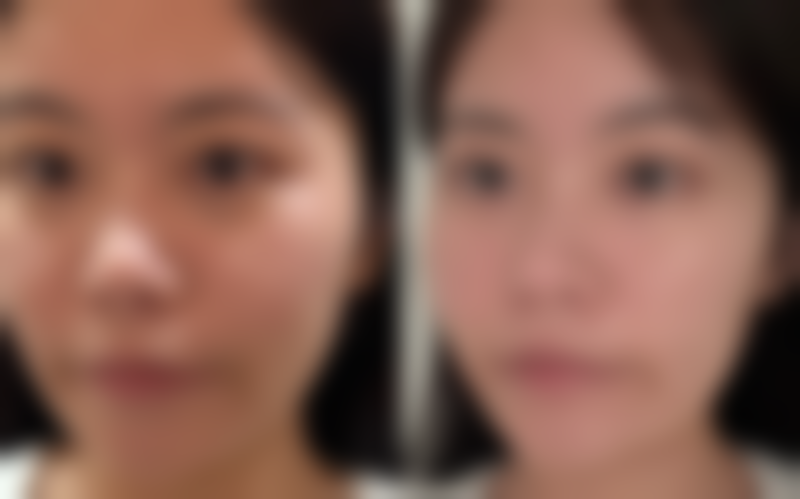 四、陆忠凯医生口碑评价好