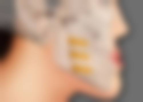 胡丽莎医生技术优势