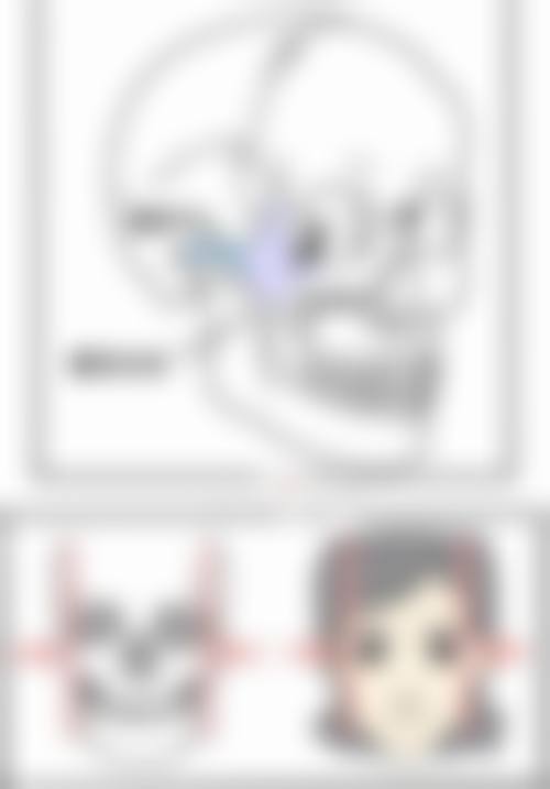 深圳不同医生玻尿酸填充额头价格