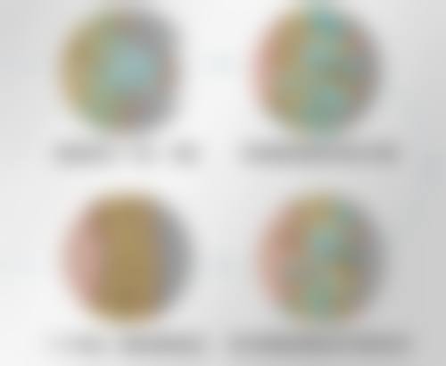 相关科普内容推荐：系统性红斑狼疮诊疗