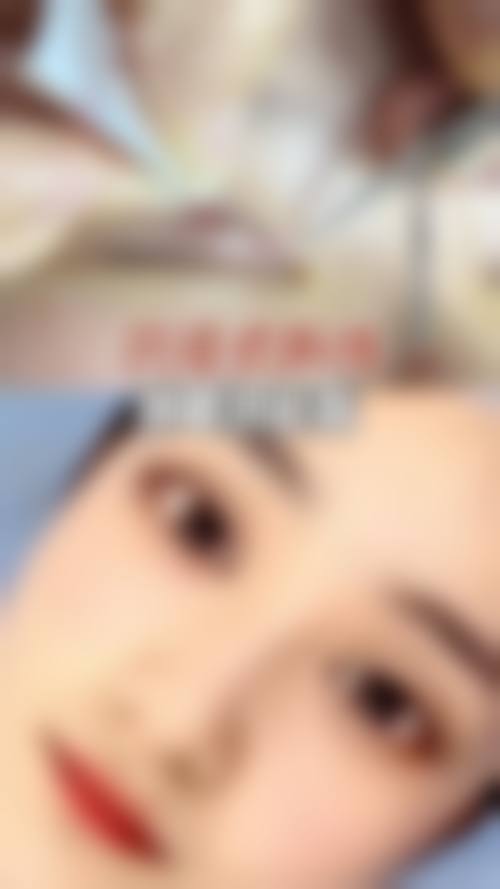 双眼皮窄改宽手术的风险