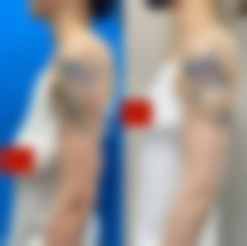 恒博天姿价格表公开！热门项目费用明细+优惠活动