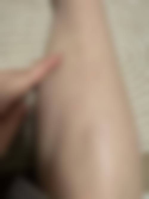 二、文辉才擅长项目及优势