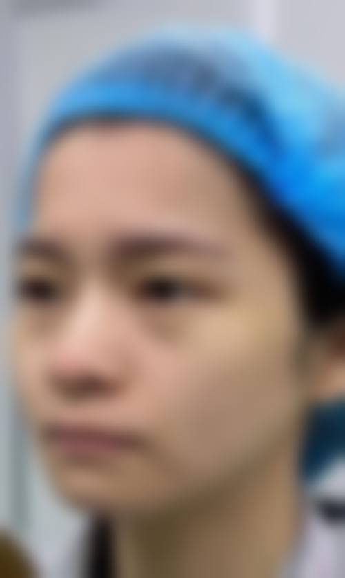 三、从医学角度看,怎么按摩让眼袋消除?掌握眼周3大穴位按摩法的核心目的是什么?