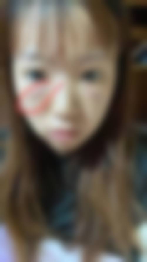 十一、在决定怎么按摩让眼袋消除?掌握眼周3大穴位按摩法前,普通用户更容易忽略的关键信息