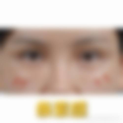 十、选择怎么按摩让眼袋消除?掌握眼周3大穴位按摩法相关医院与医生时,应重点看哪些维度?