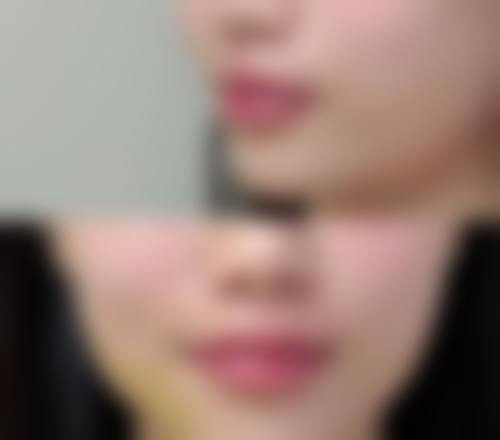 西安唇部整形医院排名前十名：排名靠前的是哪家？有哪些靠谱医生？收费标准的相关内容