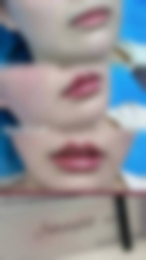 西安唇部整形排名第4名——西安艺星