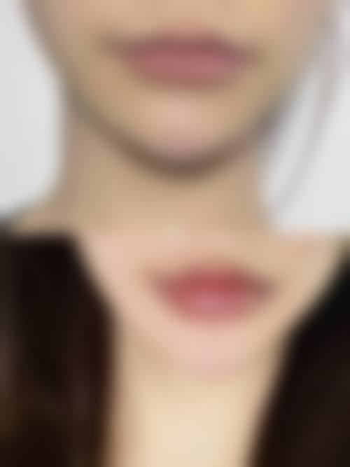 西安唇部整形排名第1名——西安高一生医疗美容医院