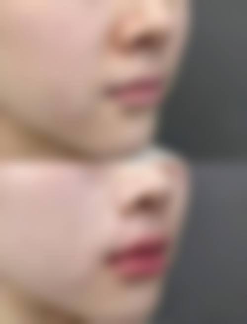 西安唇部整形排名第5名——西安国医