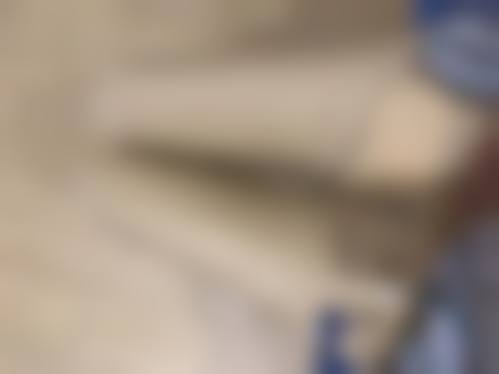 杭州天鑫医疗美容医院服务态度怎么样？口碑和技术靠谱吗？专业团队+真人案例说话，双眼皮3000+起，抽脂效果自然不反弹！