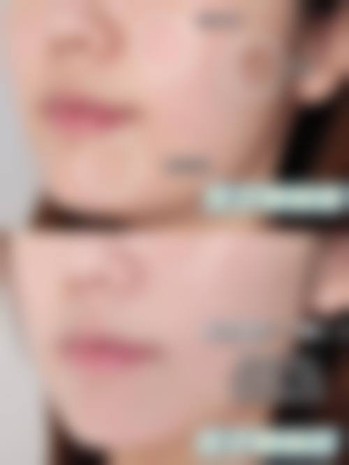 刘屾医生口碑怎么样？