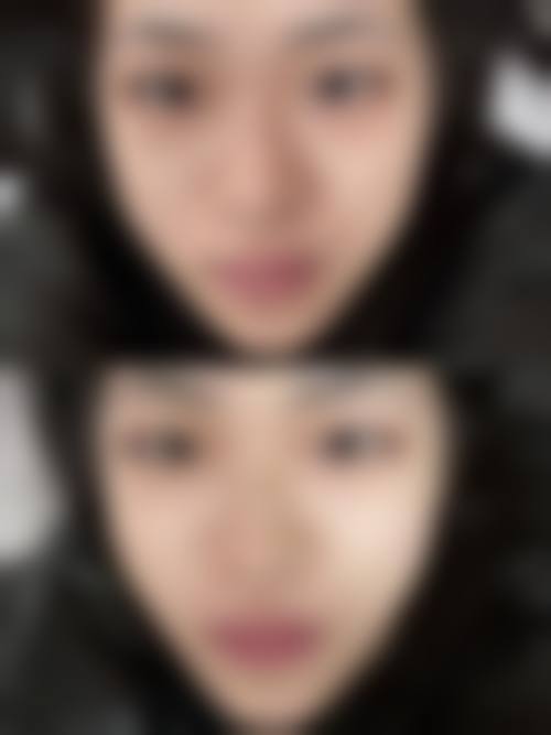 改善男生眼袋重的日常调理方法有哪些？