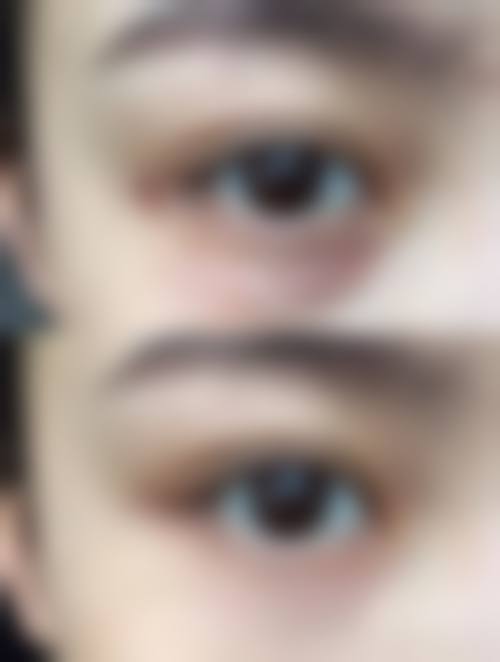 五、在实际操作中,怎么按摩让眼袋消除?掌握眼周3大穴位按摩法更适合哪些人?