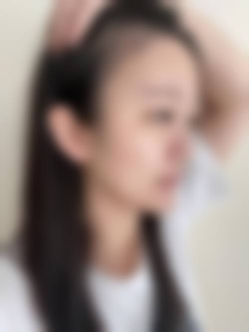 妙馨医疗美容真实实例参考