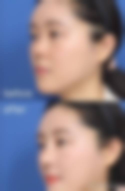 恒博天姿预约挂号方式？3种渠道，方便快捷！