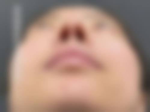 如何避免渠道医院？恒博天姿教你3招避坑！