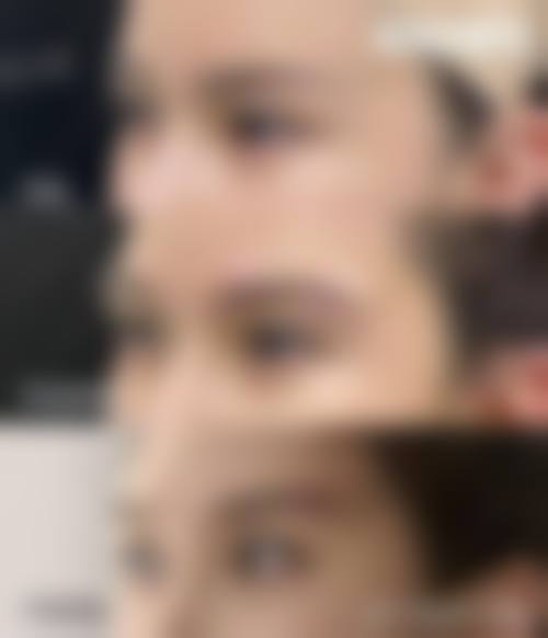 吊顶双眼皮怎么选择装修团队？